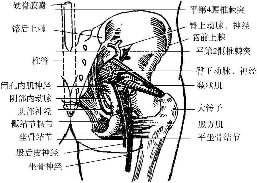 二、梨狀肌的解剖與坐骨神經(jīng)通道